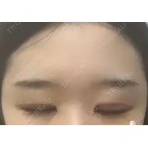 ブリスクリニック形成外科・美容外科・美容皮膚科 福岡口コミ