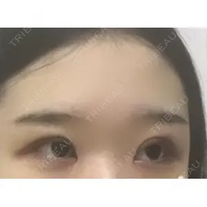 ブリスクリニック形成外科・美容外科・美容皮膚科 福岡口コミ