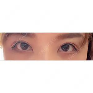 TCB東京中央美容外科 TCB東京中央美容外科 心斎橋筋院口コミ