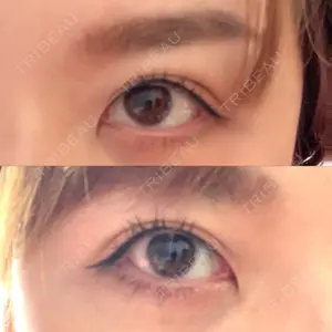 TCB東京中央美容外科 TCB東京中央美容外科 心斎橋筋院口コミ