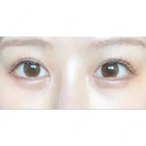 APOLLO BEAUTY CLINIC口コミ