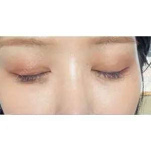 APOLLO BEAUTY CLINIC口コミ