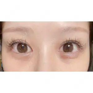 APOLLO BEAUTY CLINIC口コミ