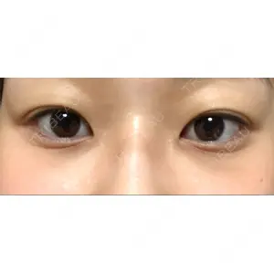APOLLO BEAUTY CLINIC口コミ