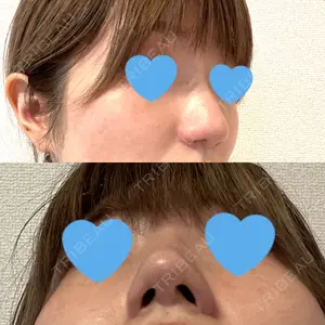 グローバルビューティークリニック グローバルビューティークリニック 東京院口コミ