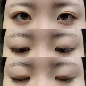 東京イセアクリニック口コミ