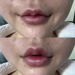 ルラ美容クリニック ルラ美容クリニック 高田馬場院口コミ