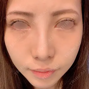 VENUS BEAUTY CLINIC　銀座院口コミ