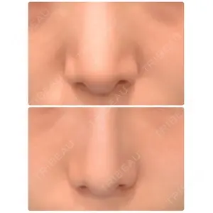 VENUS BEAUTY CLINIC　銀座院口コミ