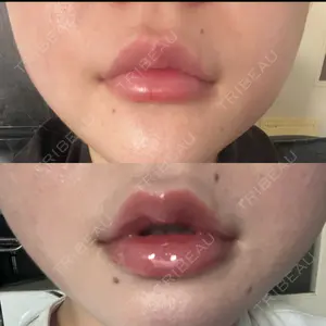 ルラ美容クリニック ルラ美容クリニック 高田馬場院口コミ