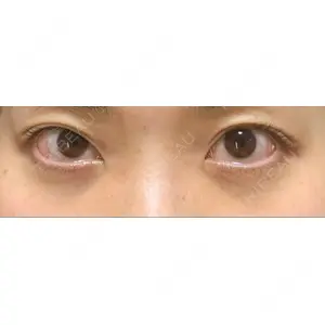 APOLLO BEAUTY CLINIC口コミ