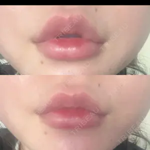 ルラ美容クリニック ルラ美容クリニック 高田馬場院口コミ