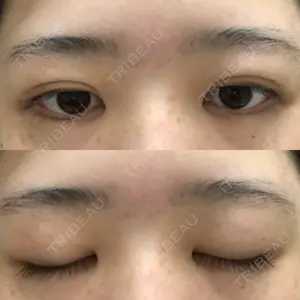 東京BELLEZZAクリニック口コミ