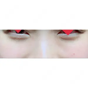 APOLLO BEAUTY CLINIC口コミ