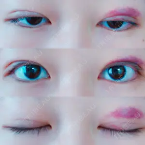 湘南美容クリニック 湘南美容クリニック 東京蒲田院口コミ