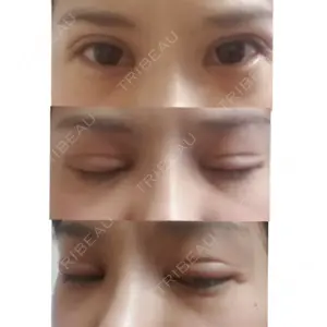 聖心美容クリニック グループ 聖心美容クリニック 札幌院口コミ