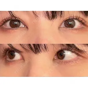 APOLLO BEAUTY CLINIC口コミ