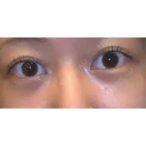 APOLLO BEAUTY CLINIC口コミ