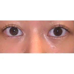 APOLLO BEAUTY CLINIC口コミ