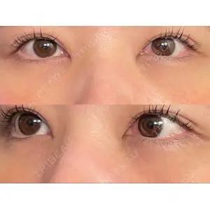 APOLLO BEAUTY CLINIC口コミ