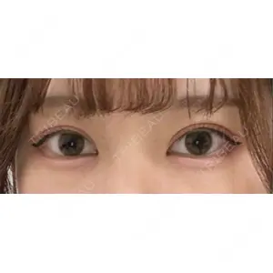 東京BELLEZZAクリニック口コミ