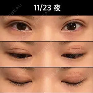 ルネッサンス美容外科医院 ルネッサンス美容外科医院 東京院口コミ
