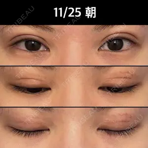 ルネッサンス美容外科医院 ルネッサンス美容外科医院 東京院口コミ