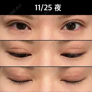 ルネッサンス美容外科医院 ルネッサンス美容外科医院 東京院口コミ