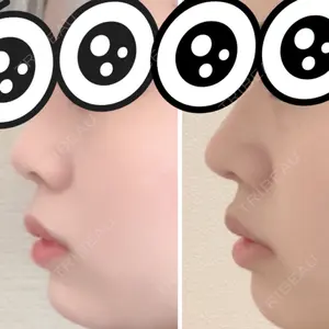 口コミ