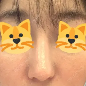 HANABI整形外科口コミ