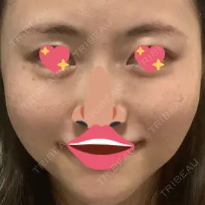 南青山TOKUNAKAクリニック口コミ