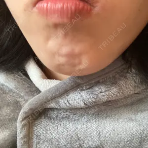 湘南美容クリニック 湘南美容クリニック 自由が丘院口コミ