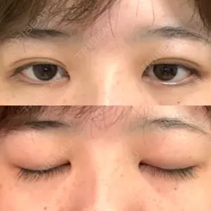 東京BELLEZZAクリニック口コミ