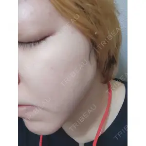 医療法人社団 創輝会 GROUP PICO BEAUTY CLINIC口コミ