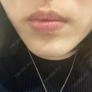 湘南美容クリニック 湘南美容クリニック 自由が丘院口コミ