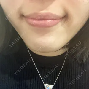 湘南美容クリニック 湘南美容クリニック 自由が丘院口コミ