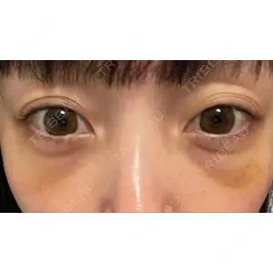 APOLLO BEAUTY CLINIC口コミ