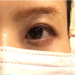 くさのたろうクリニック口コミ