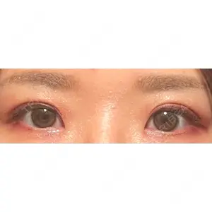 東京BELLEZZAクリニック口コミ