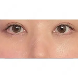 APOLLO BEAUTY CLINIC口コミ
