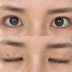 表参道スキンクリニック 表参道スキンクリニック 表参道院口コミ