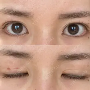 表参道スキンクリニック 表参道スキンクリニック 表参道院口コミ