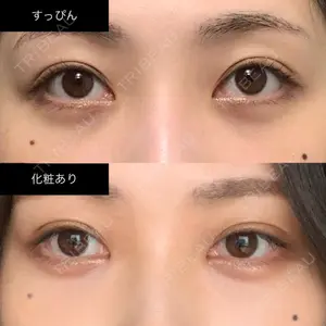 APOLLO BEAUTY CLINIC口コミ