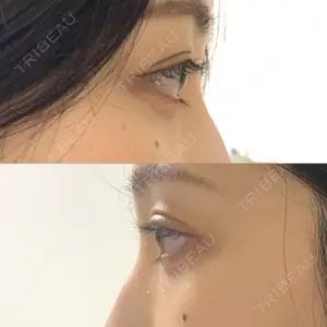 APOLLO BEAUTY CLINIC口コミ