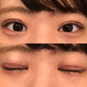 東京皮膚科・形成外科 東京皮膚科・形成外科 (銀座いけだクリニック)口コミ