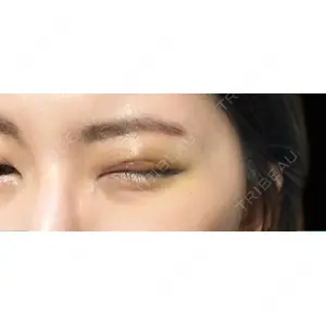 牧野美容クリニック口コミ