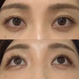 APOLLO BEAUTY CLINIC口コミ