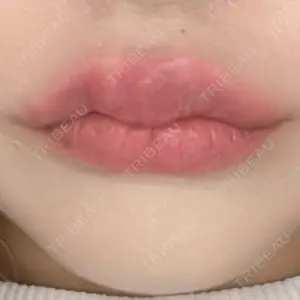 ルラ美容クリニック ルラ美容クリニック 高田馬場院口コミ