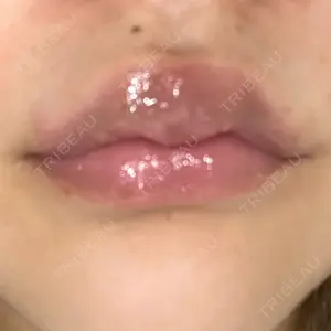 ルラ美容クリニック ルラ美容クリニック 高田馬場院口コミ