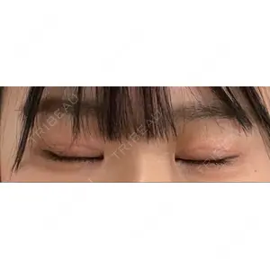 東京イセアクリニック口コミ
